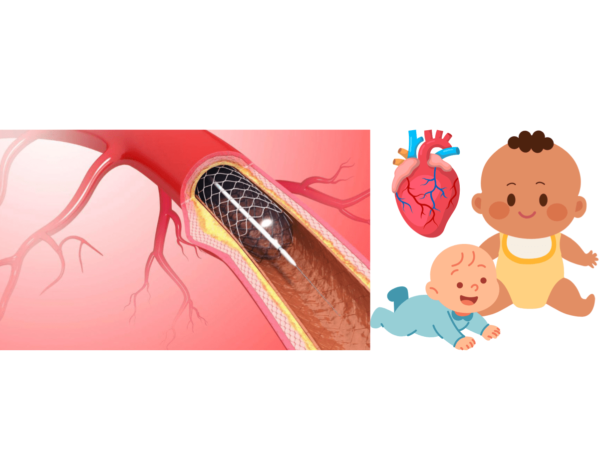 Finding Success in the First FDA-Approved Stent for Babies Born with Heart&nbsp;Disease