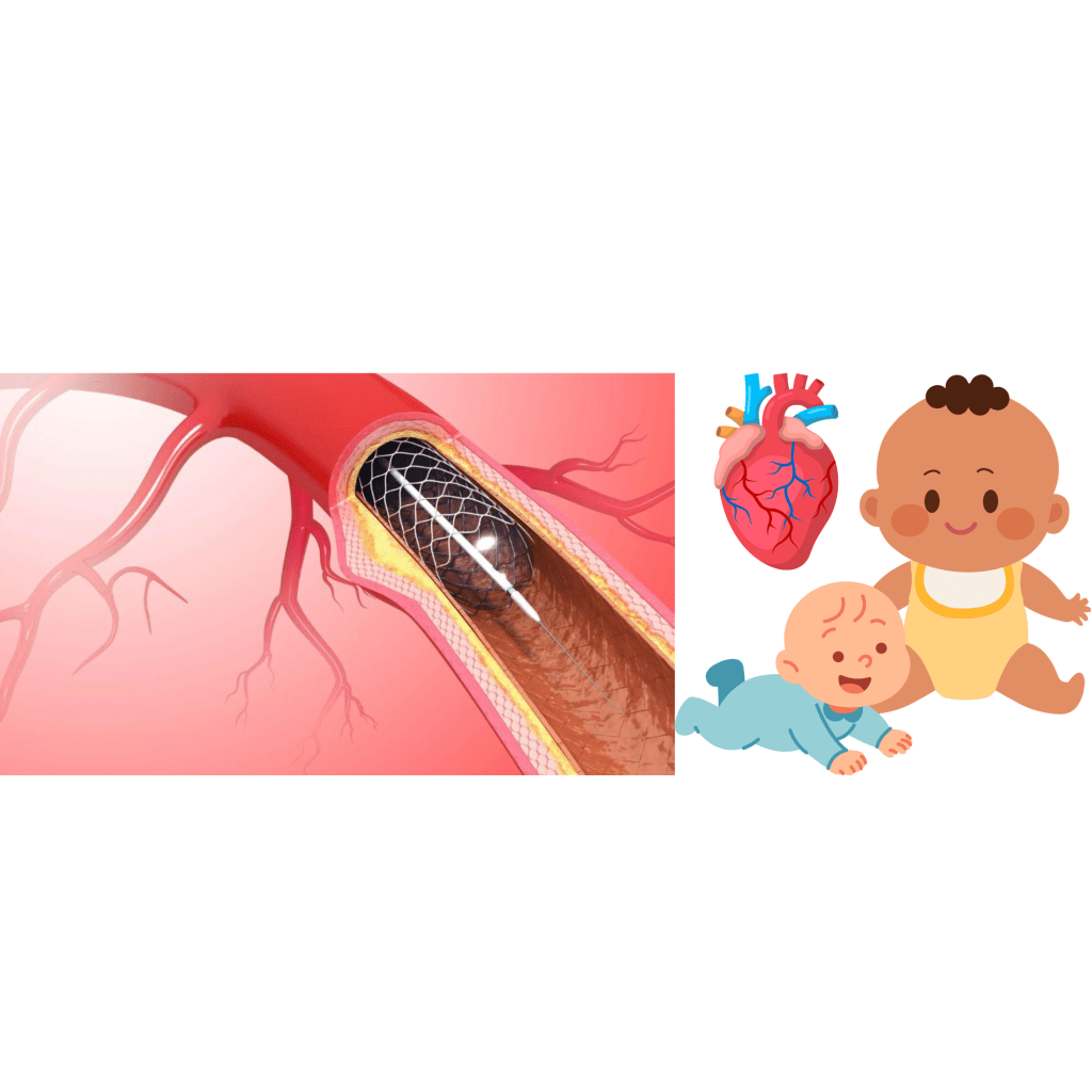 cardiovascular stent image, plus babies and a heart organ image